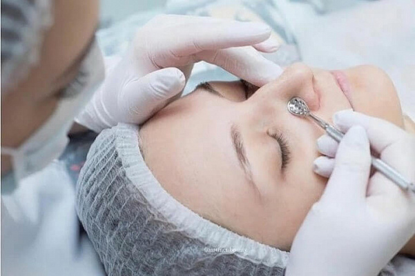 Пилинг лица. Ultra Подарки Нижний Новгород. Подарочный сертификат на натуральную пилинг лица. Ultra Подарки Нижний Новгород. 8 800-505-9503. Пилинг лица  #вМоскве#, чистка лица, очищение лица, химический пилинг