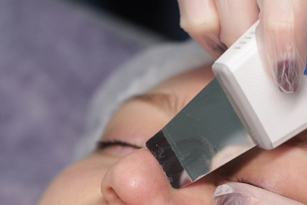 Пилинг лица. Ultra Подарки Нижний Новгород. Подарочный сертификат на натуральную пилинг лица. Ultra Подарки Нижний Новгород. 8 800-505-9503. Пилинг лица  #вМоскве#, чистка лица, очищение лица, химический пилинг