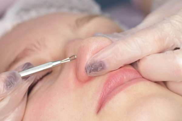 Пилинг лица. Ultra Подарки Нижний Новгород. Подарочный сертификат на натуральную пилинг лица. Ultra Подарки Нижний Новгород. 8 800-505-9503. Пилинг лица  #вМоскве#, чистка лица, очищение лица, химический пилинг