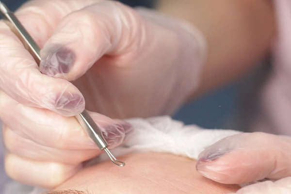 Пилинг лица. Ultra Подарки Нижний Новгород. Подарочный сертификат на натуральную пилинг лица. Ultra Подарки Нижний Новгород. 8 800-505-9503. Пилинг лица  #вМоскве#, чистка лица, очищение лица, химический пилинг