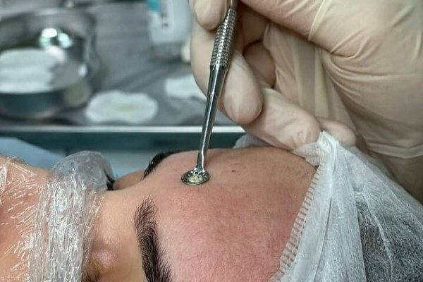 Пилинг лица. Ultra Подарки Нижний Новгород. Подарочный сертификат на натуральную пилинг лица. Ultra Подарки Нижний Новгород. 8 800-505-9503. Пилинг лица  #вМоскве#, чистка лица, очищение лица, химический пилинг